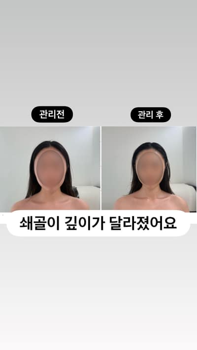 [경기 하남시] 승모근 & 목어깨 관리