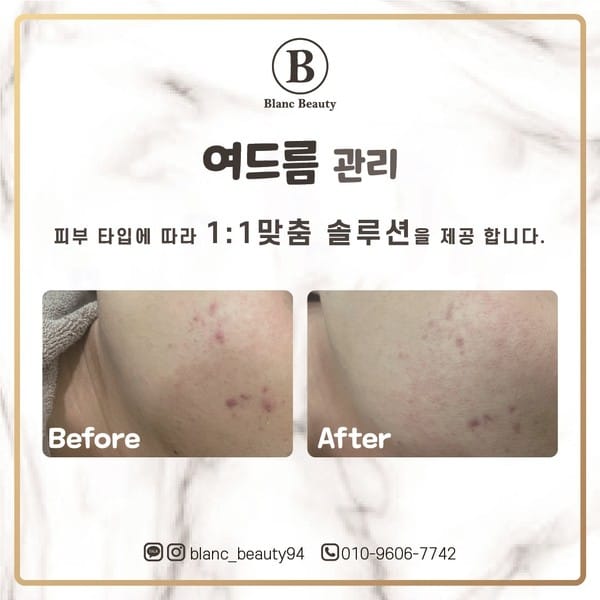 [부산 기장] 블랑뷰티