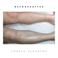 포레스트 로고